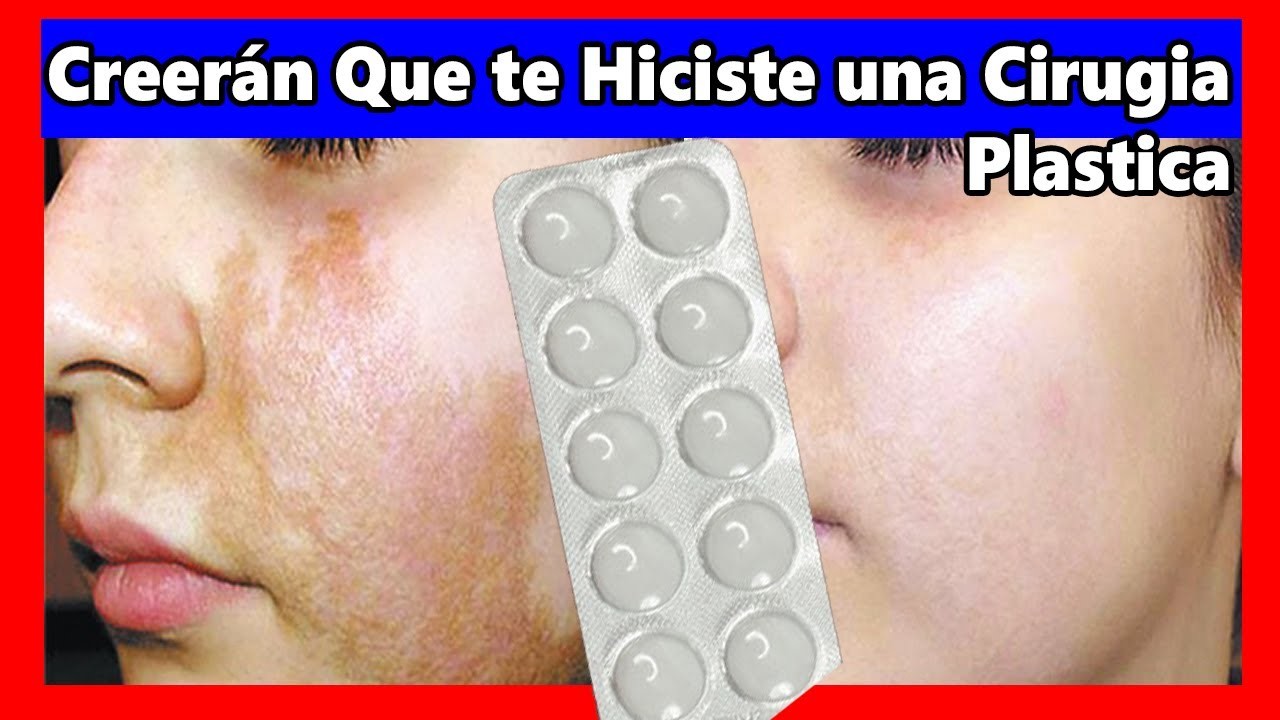 Adiós a las machas, cicatrices Y espinilla con esta mascarilla