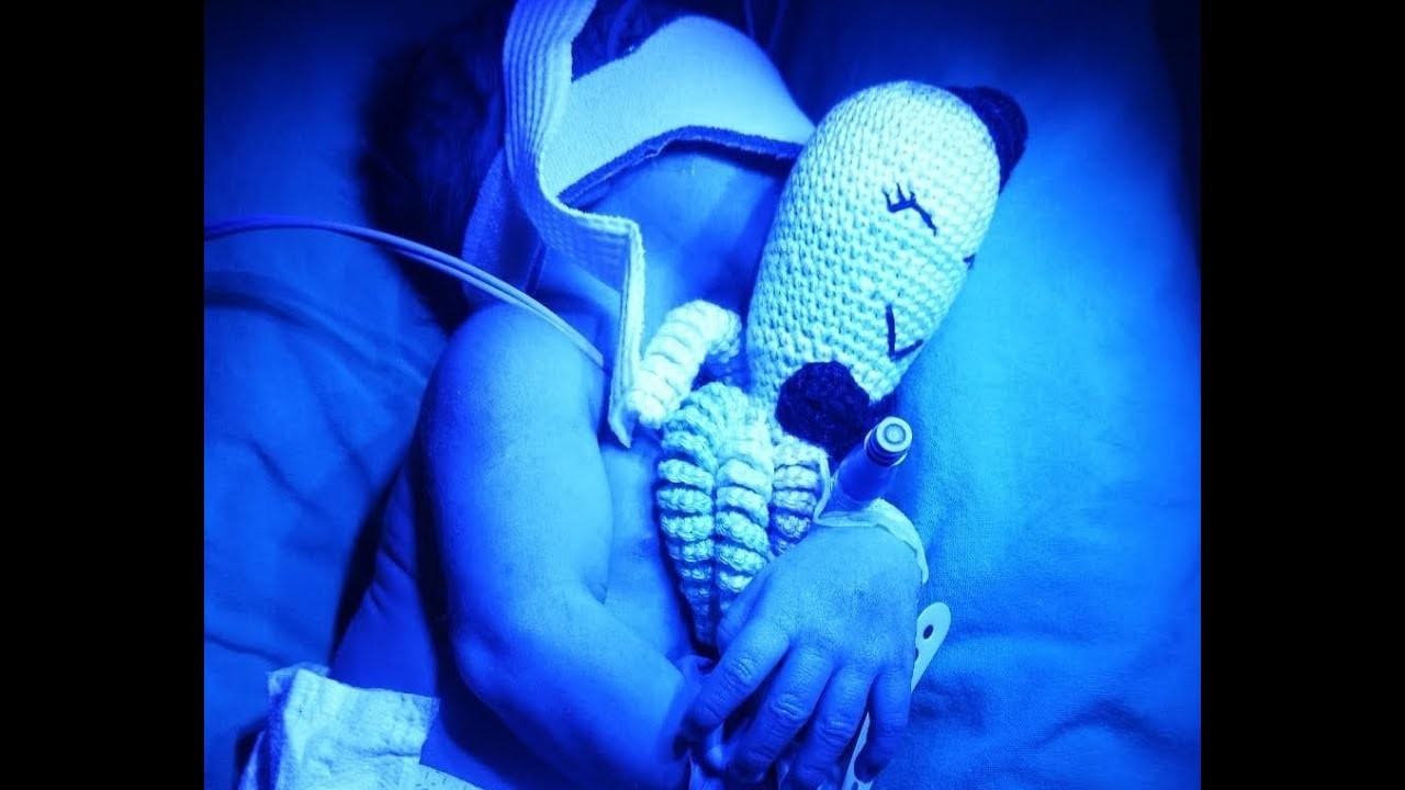 Pulpitos tejidos ayudan a bebés prematuros - aDiarioCR