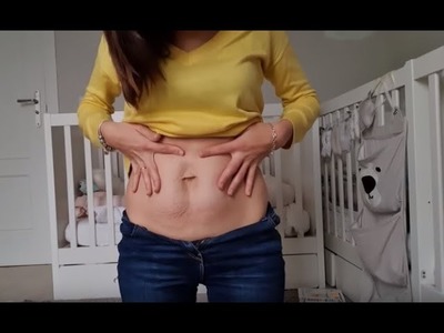 ¿Cómo quedó mi abdomen tras el ????? +  DIASTASIS ABDOMINAL ???????????? Embarazo de trillizos