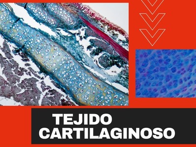 Histología.TEJIDO CARTILAGINOSO. .  CARTÍLAGO ✔????