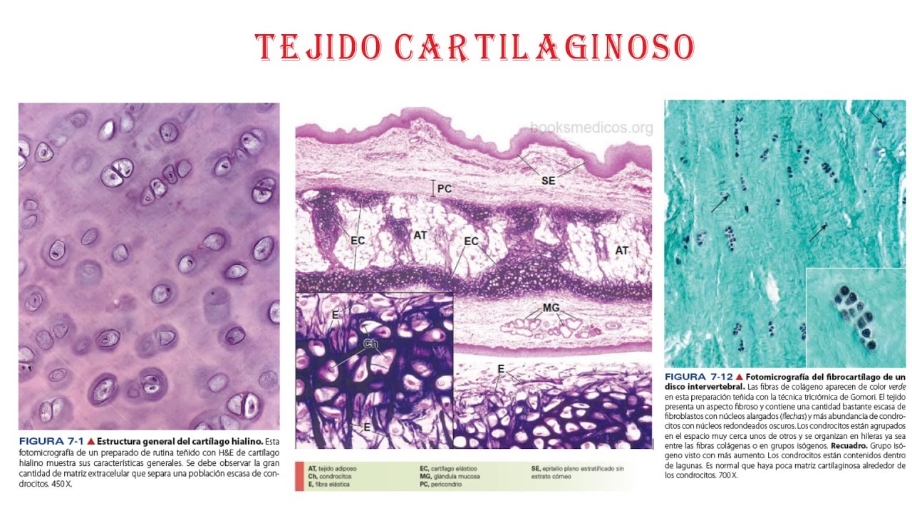 Tejido Conectivo