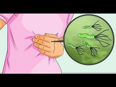 Este médico japonés te revela como eliminar de raíz la bacteria Helicobacter Plyori que provoca l
